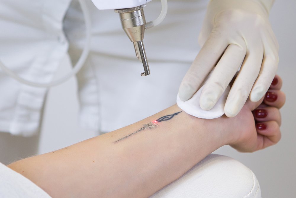 4 Things You Should Know Before Getting a Tattoo