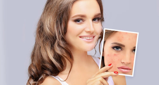What Can BBL and Halo Laser Treatments Do for You?