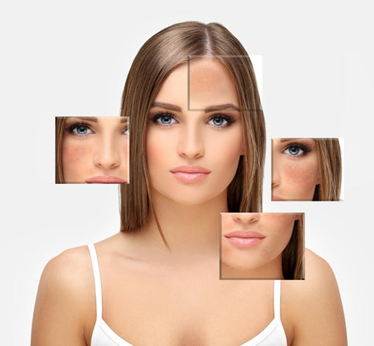 Botox or Dermal Fillers- Which One Is Your Skin Craving?