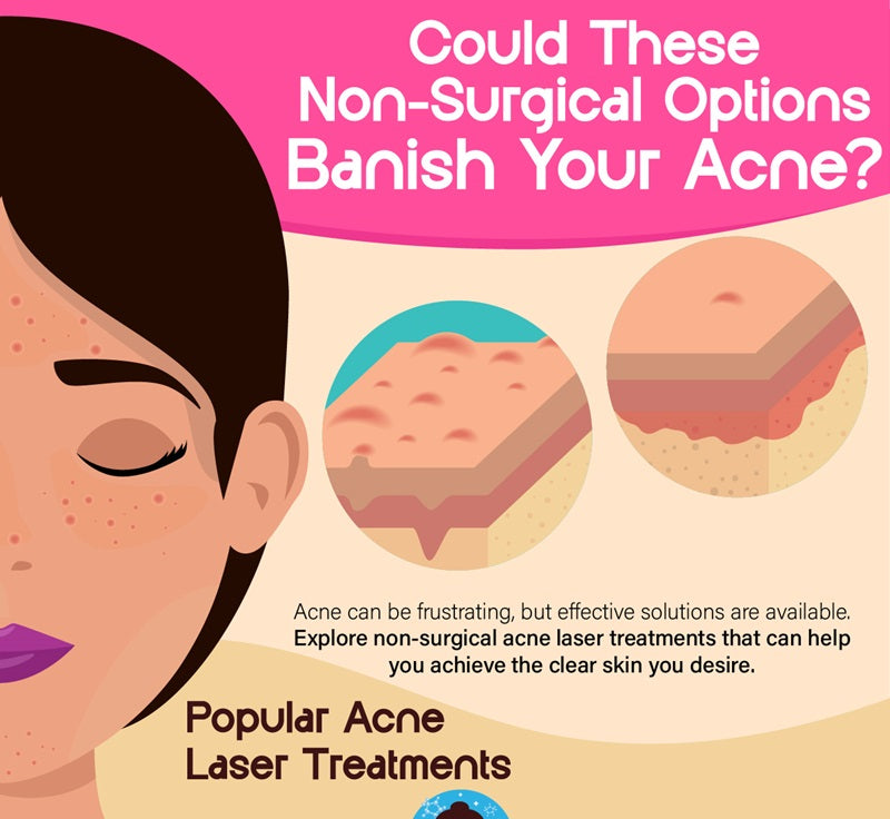 Could These Non-Surgical Options Banish Your Acne?