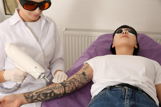 Decode Laser Tattoo Removal: Eleven Key Points You Must Know