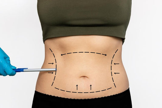 Emsculpt: Get The Body You Want And Look Confident