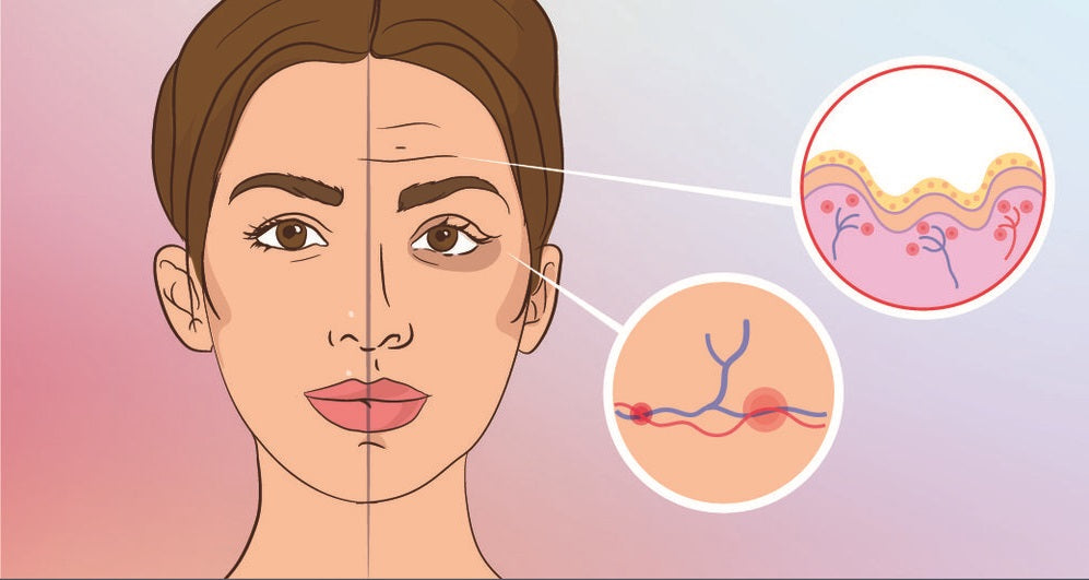 How Can You Prevent Skin Aging And Look More Beautiful ?