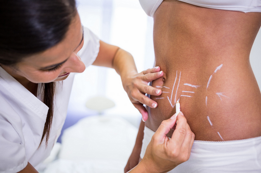 How Can CoolSculptingHelp Reduce Stubborn Fat?
