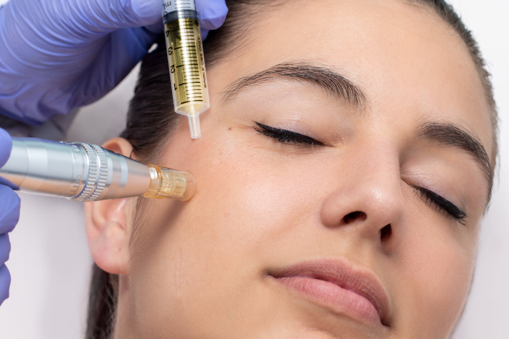 Microneedling PRP OKC