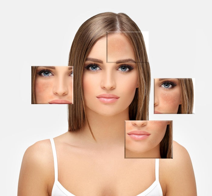 Botox or Dermal Fillers- Which One Is Your Skin Craving?