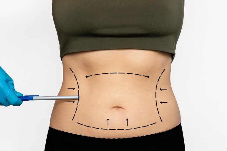 Emsculpt: Get The Body You Want And Look Confident