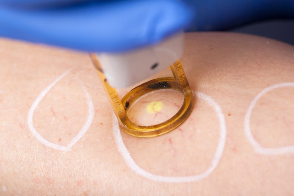 Emsculpt Vs CoolSculpting: Which Is the Right Body Contouring Option for You?
