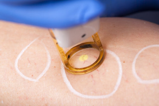 Emsculpt Vs CoolSculpting: Which Is the Right Body Contouring Option for You?