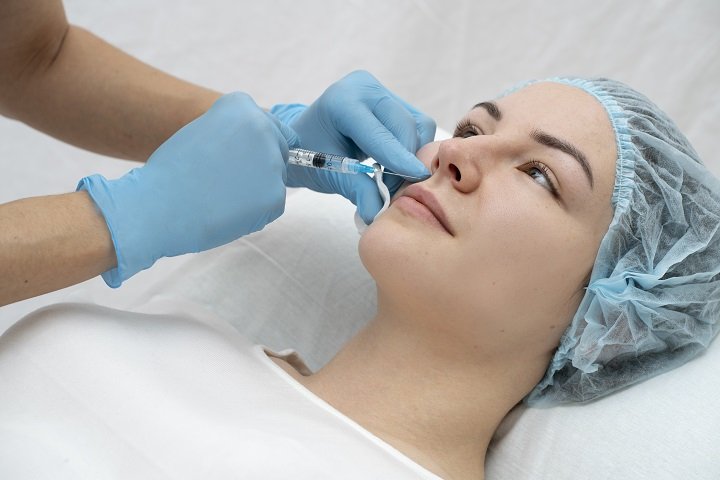 Longevity of Beauty: JUVÉDERM VOLUMA® XC's Lasting Effects