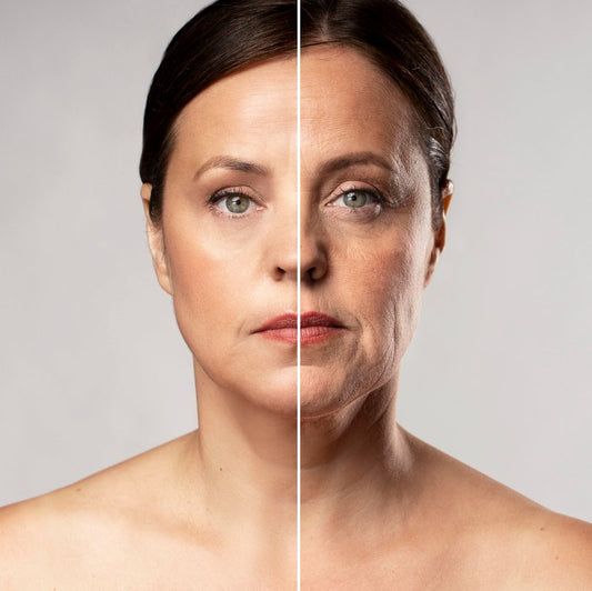 Thermage: The Latest Non-Invasive Skin Tightening Treatment