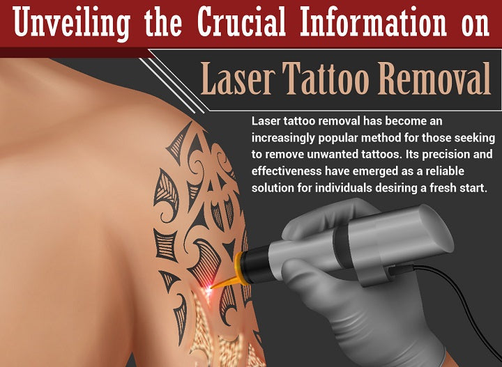 Unveiling the Crucial Information on Laser Tattoo Removal