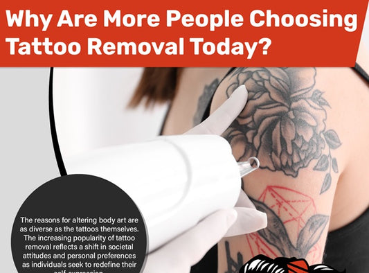 Why Are More People Choosing Tattoo Removal Today?
