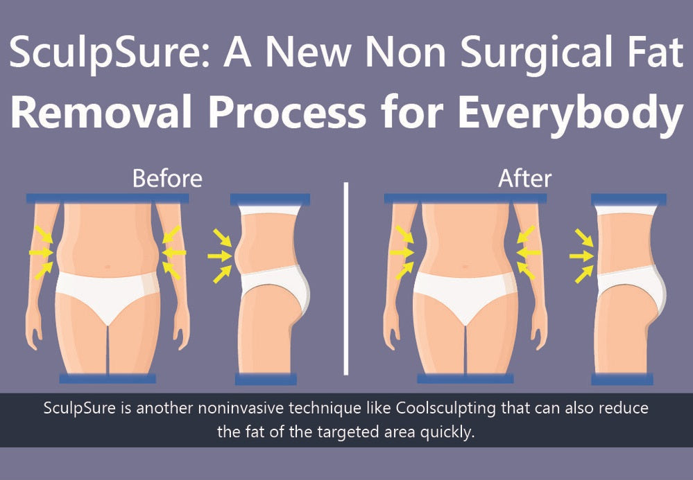 SculpSure: A New Non Surgical Fat Removal Process For Everybody