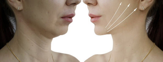 Debunking Some of the Common Myths About Liquid Facelift