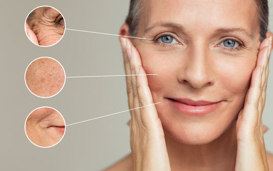 Choose BBL For Younger And Rejuvenated Skin