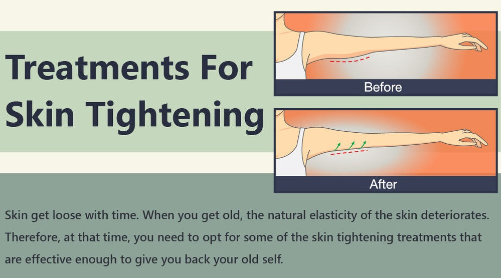 Treatment For Skin Tightening