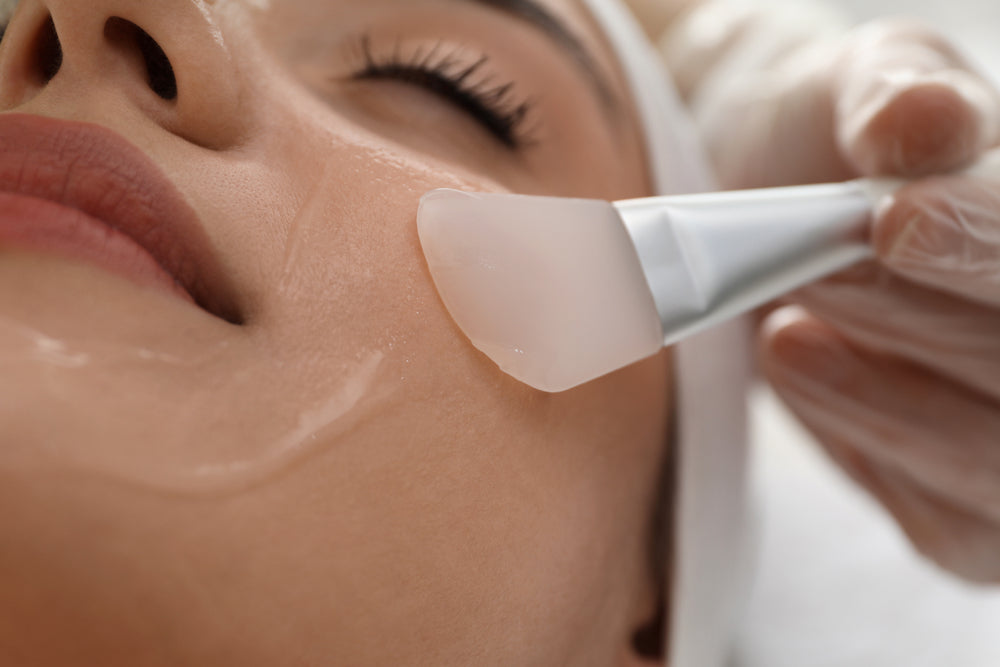 Chemical Peels For Active Scarring