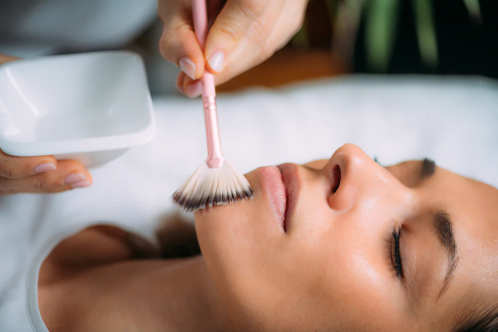 Chemical Peels