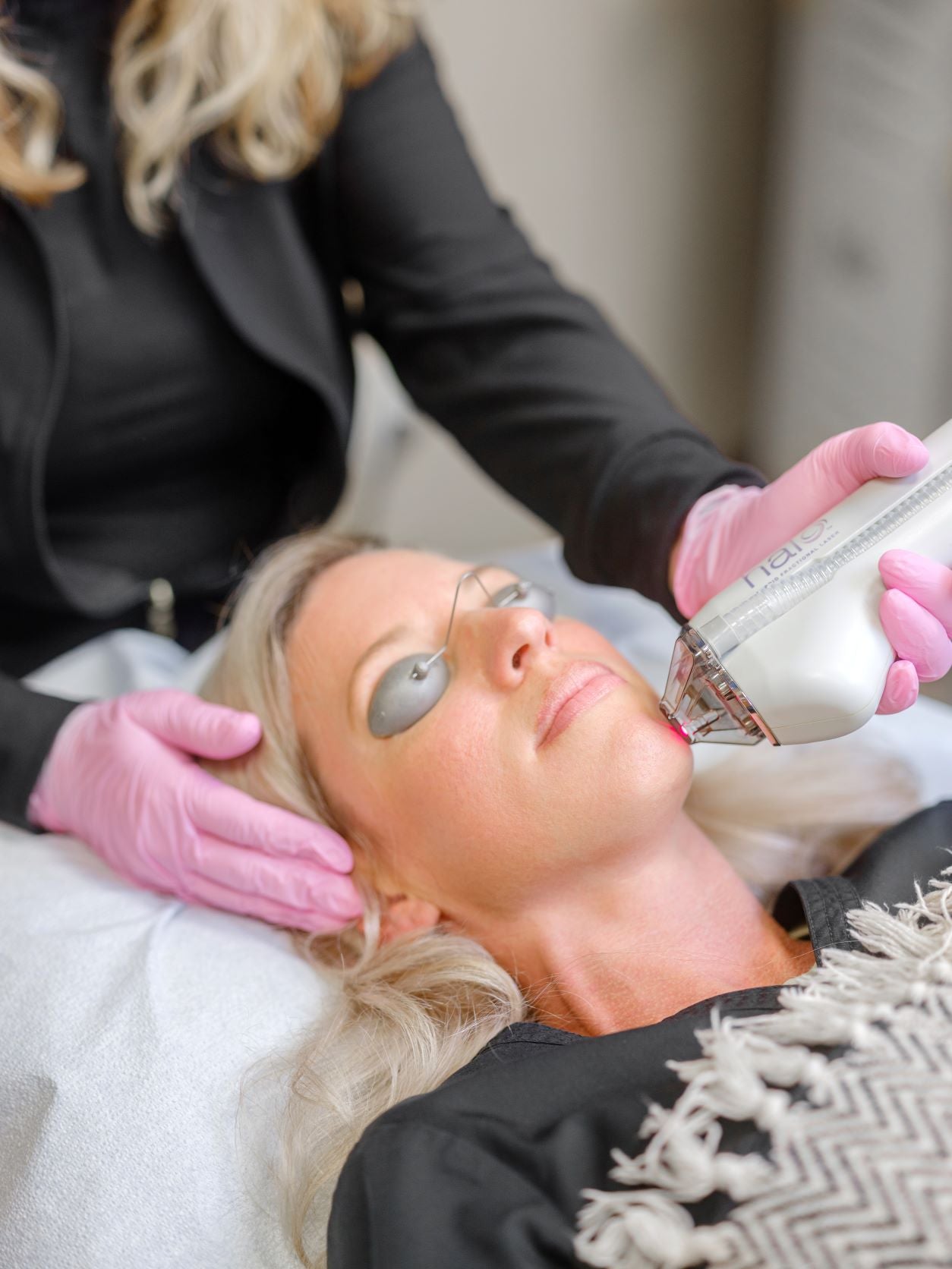 Halo Facial Laser treatments