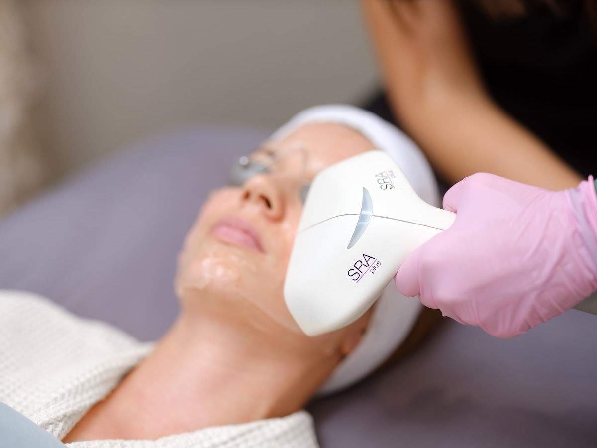 Elos Fractional Laser
