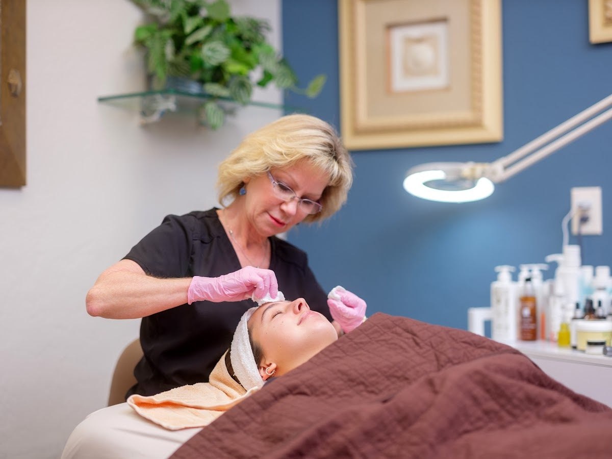 Chemical Peels