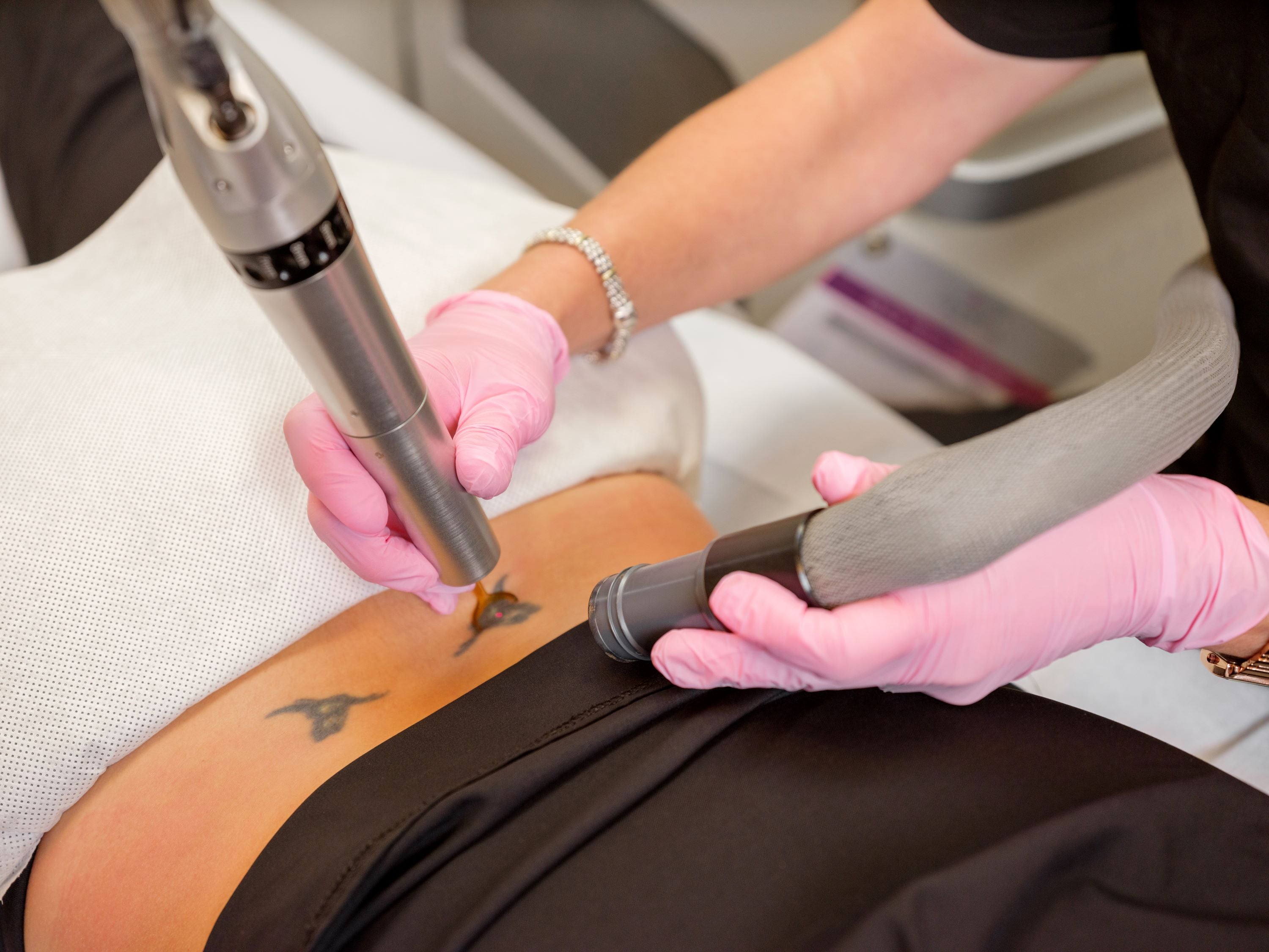 Take that tattoo off your skin! - Vive Medical Spa