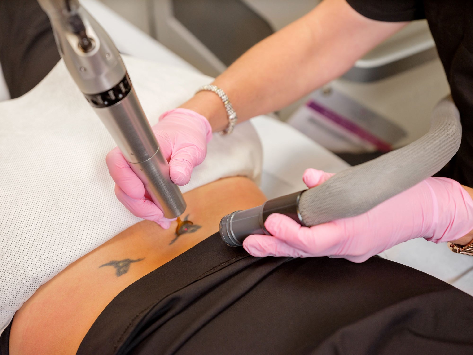 Tattoo Removal in Oklahoma City