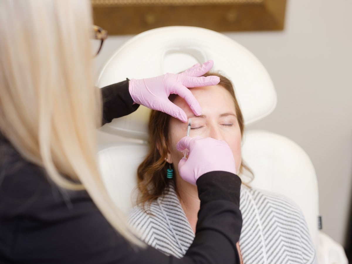 Benefits of Dermal Fillers