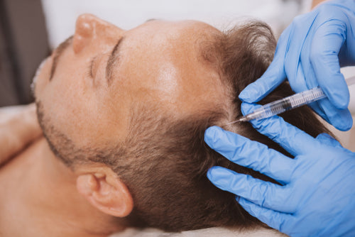 PRP Hair Treatments