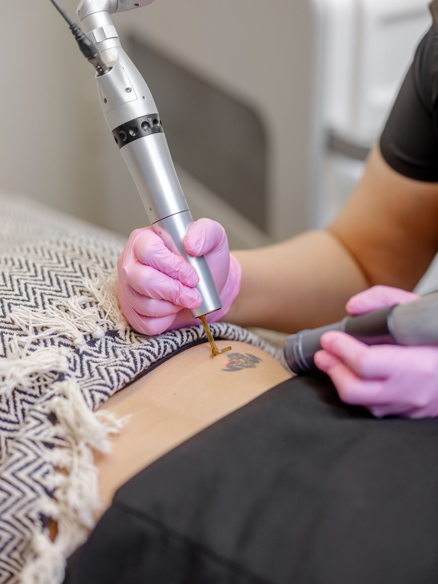 Tattoo Removal Oklahoma City