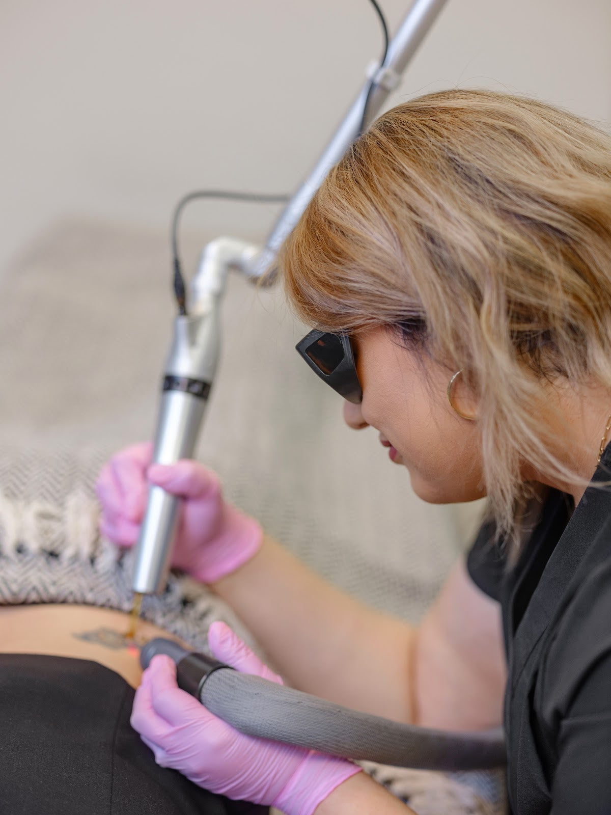 tattoo removal session